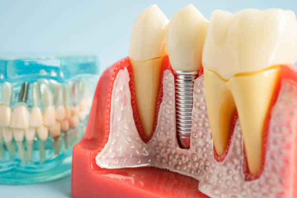 Oral Surgery in North Palm Beach, FL